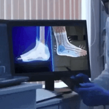 Medias de Compresión Graduada – FisioCare™
